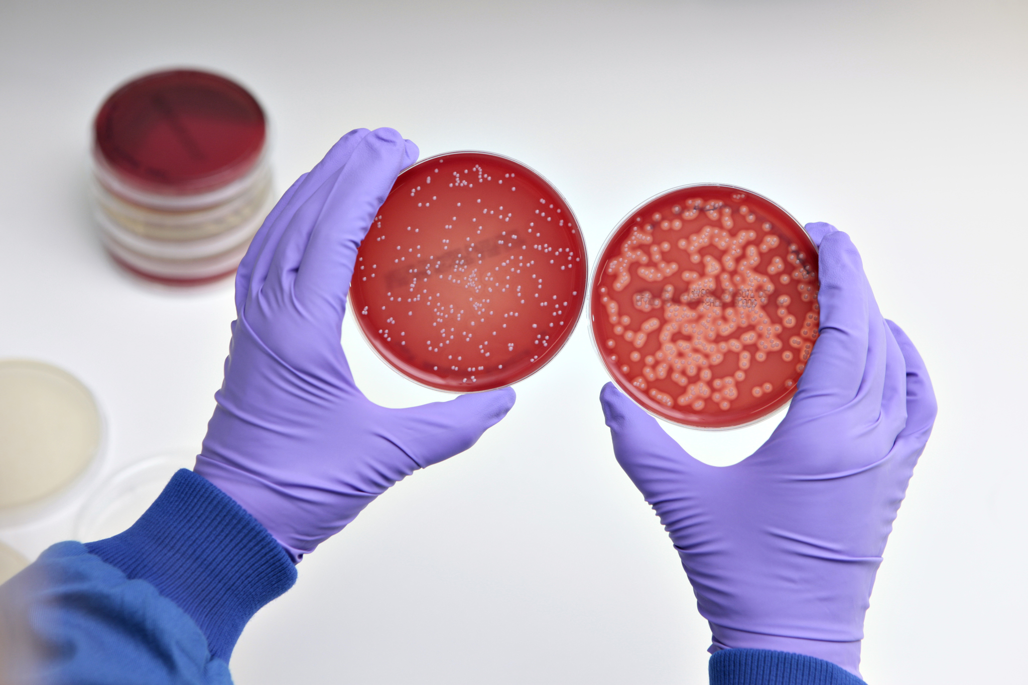 Staphylococcus aureus 4. Сапрофитный стафилококк. Стафилококки и стрептококки. Заражение стафилококком. Стрептококки заболевания кожи.