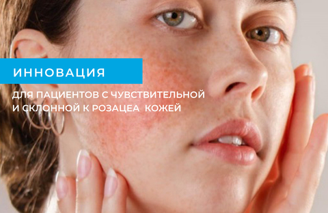 Гипоаллергенная диета при розацеа