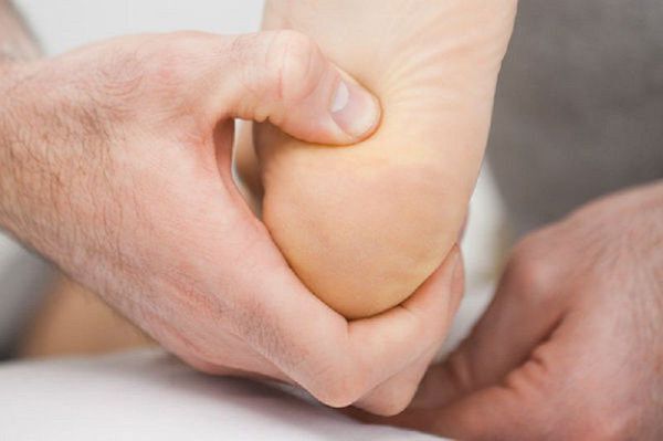 Лечение шпоры бишофитом – доступно и эффективно для больных ног