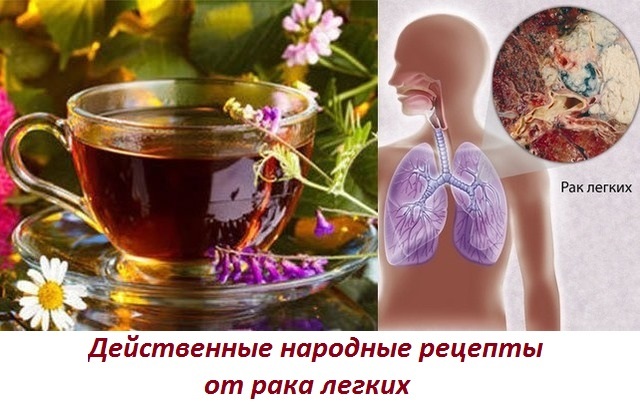 Народные методы лечения рака легких