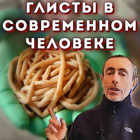 Глисты в современном человеке