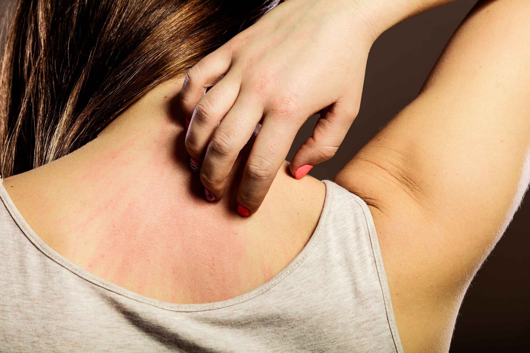 кожные заболевания на груди у женщин фото 71