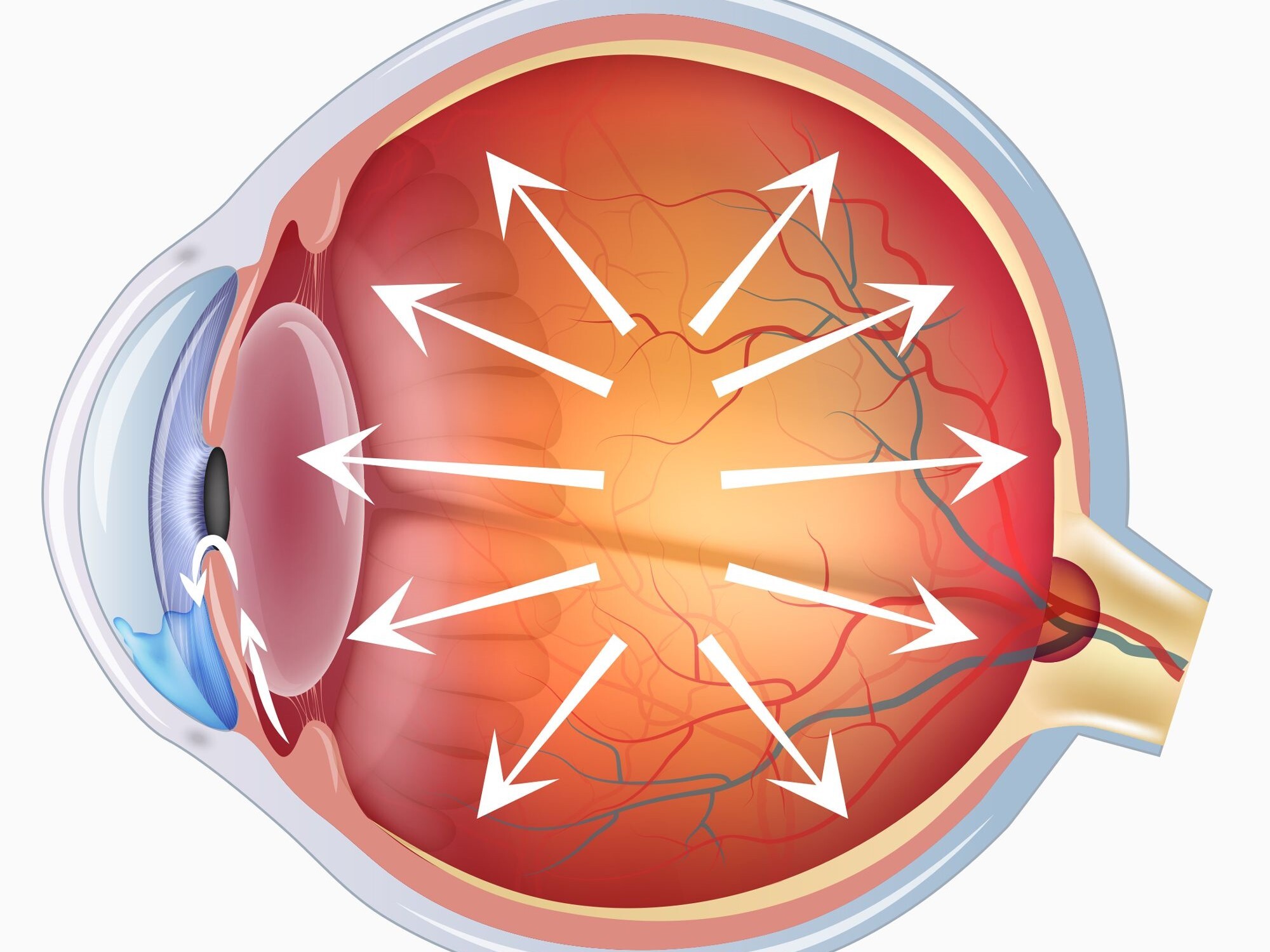 Виды операций при глаукоме