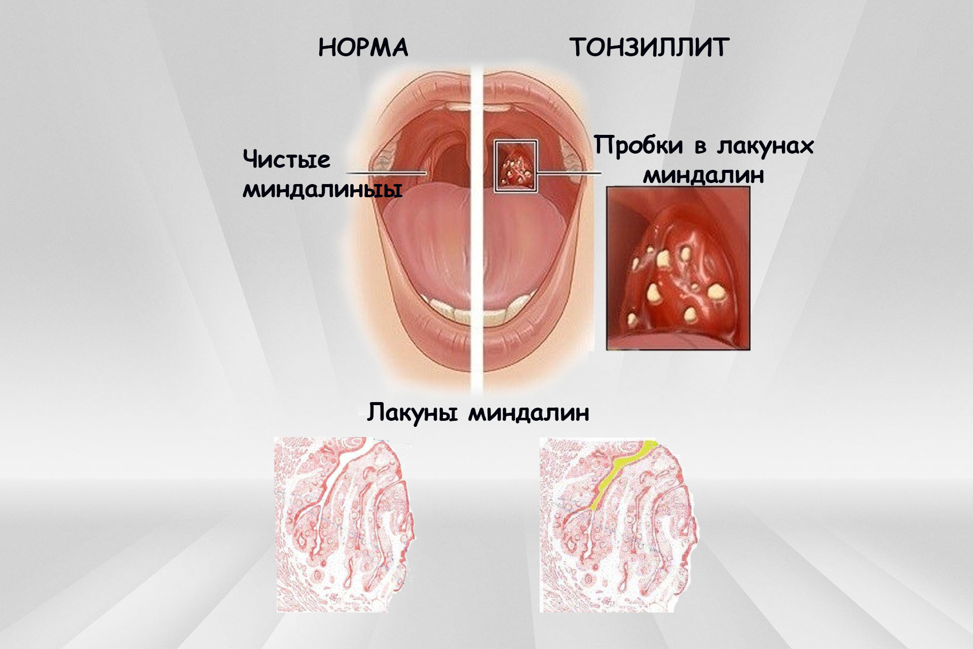 как вылечить горло минетом фото 57