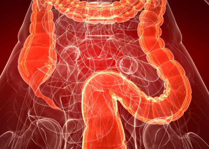 Атонический колит: причины, симптомы, диагностика, лечение