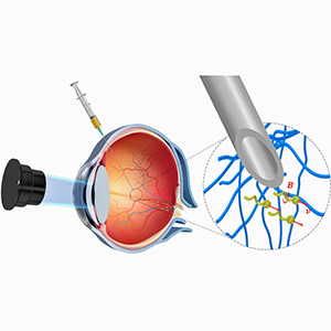 Нанороботы выполнят операцию на глазах