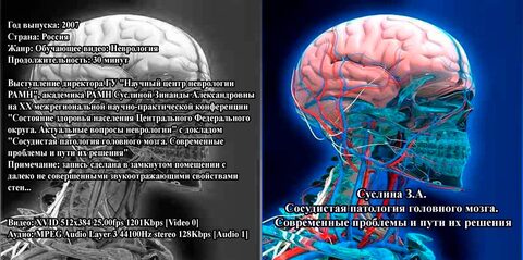 Купить Сосудистая патология головного мозга. Современные проблемы и пути их решения