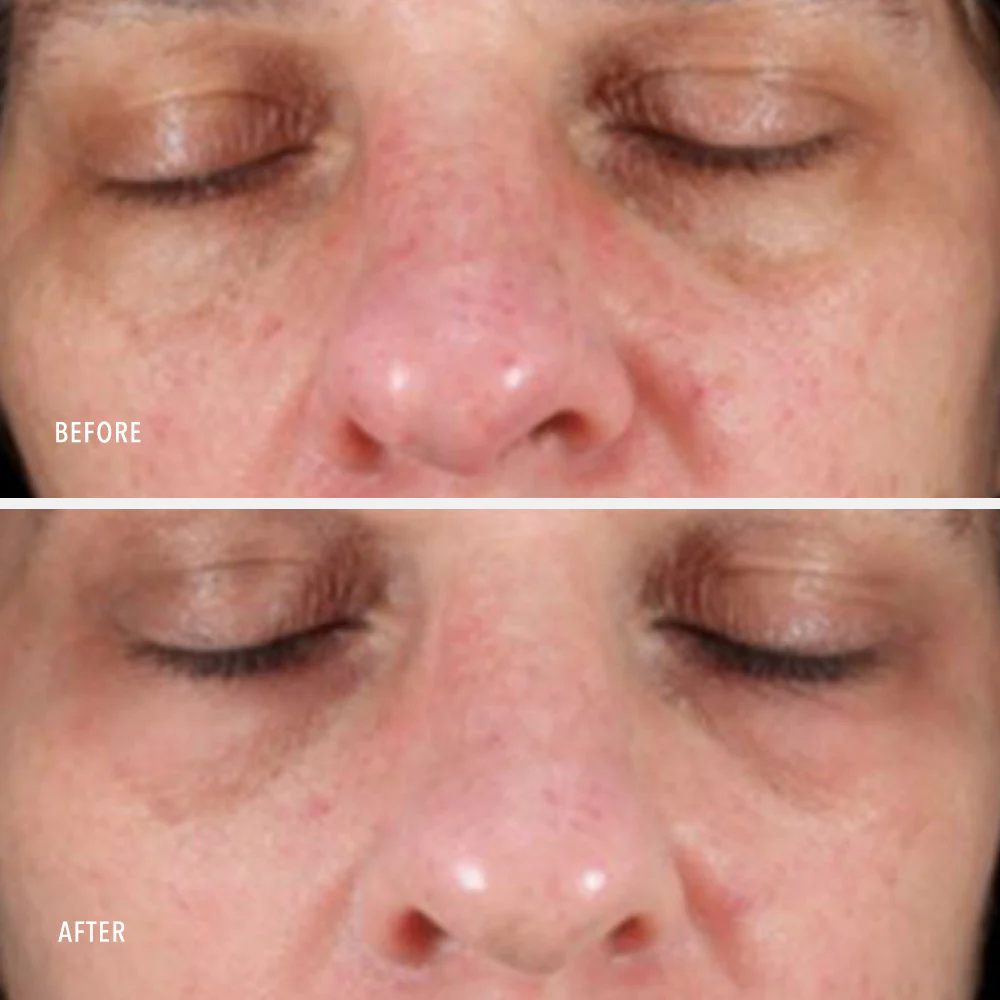 HYDROPEPTIDE Collagen Reactivate PM Активный коллагеностимулирующий лифтинг крем для ночного применения