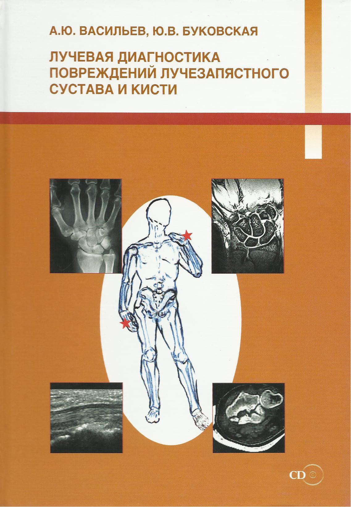 Г е труфанов лучевая диагностика. Лучевая диагностика коленного сустава. Классификация повреждений коленного сустава. Диагностика травматических повреждений. Книга по реабилитации коленного сустава.