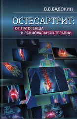 Остеоартрит: от патогенеза к рациональной терапии