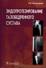Эндопротезирование тазобедренного сустава. Основы и практика