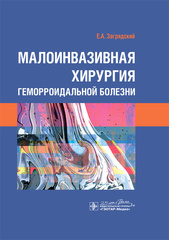 Малоинвазивная хирургия геморроидальной болезни