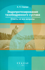 Эндопротезирование тазобедренного сустава. Ответы на все вопросы