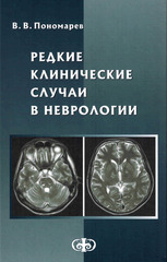 Редкие клинические случаи  в неврологии (случаи из практики)