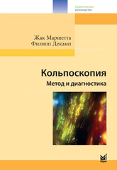 Кольпоскопия. Метод и диагностика