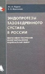 Эндопротезы тазобедренного сустава в России