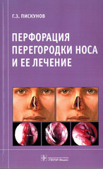 Перфорация перегородки носа и ее лечение