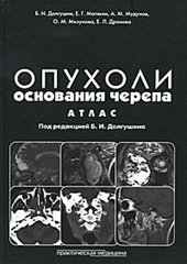 Опухоли основания черепа. Атлас