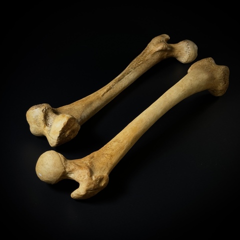 Бедренные кости человека (анатомические модели)