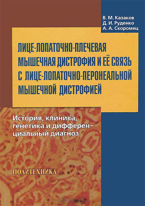 Миопатия. Амиотрофия. Мышечная дистрофия. Миодистрофия. - Медицинский центр «Эхинацея»