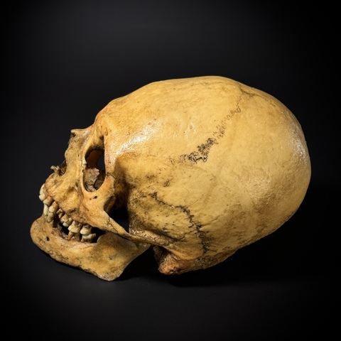 Череп человека - мужской сармат (анатомическая модель)