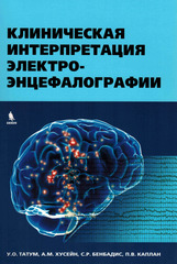 Клиническая интерпретация электроэнцефалографии