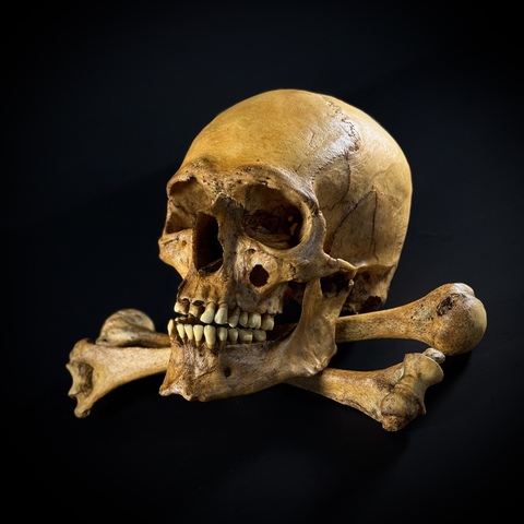 Череп человека с костями (анатомические модели)