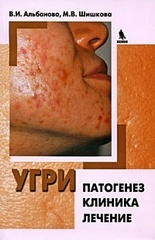 Угри: патогенез, клиника, лечение