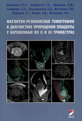 Магнитно-резонансная томография в диагностике приращения плаценты у беременных во II и III триместрах