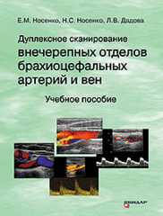 Дуплексное сканирование внечерепных отделов брахиоцефальных артерий и вен