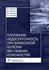 Клапанная недостаточность при варикозной болезни вен нижних конечностей