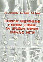 Трехмерное моделирование репозиции отломков при переломах длинных трубчатых костей