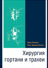 Хирургия гортани и трахеи