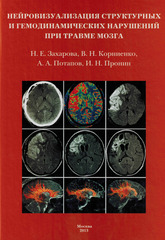 Нейровизуализация структурных и гемодинамических нарушений при травме мозга