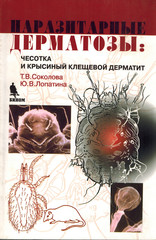 Паразитарные дерматозы: чесотка и крысиный клещевой дерматит