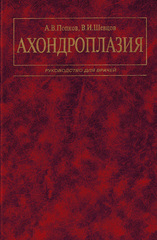 Ахондроплазия