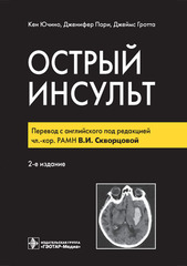 Острый инсульт