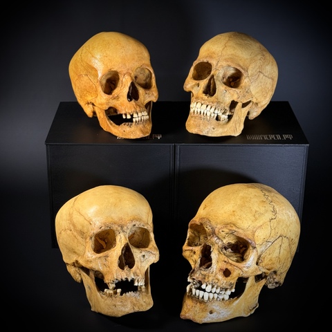 НАБОР ЧЕРЕПОВ (анатомические модели)