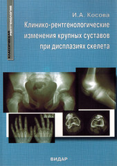 Клинико-рентгенологические изменения крупных суставов при дисплазиях скелета