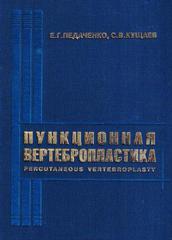 Пункционная вертебропластика