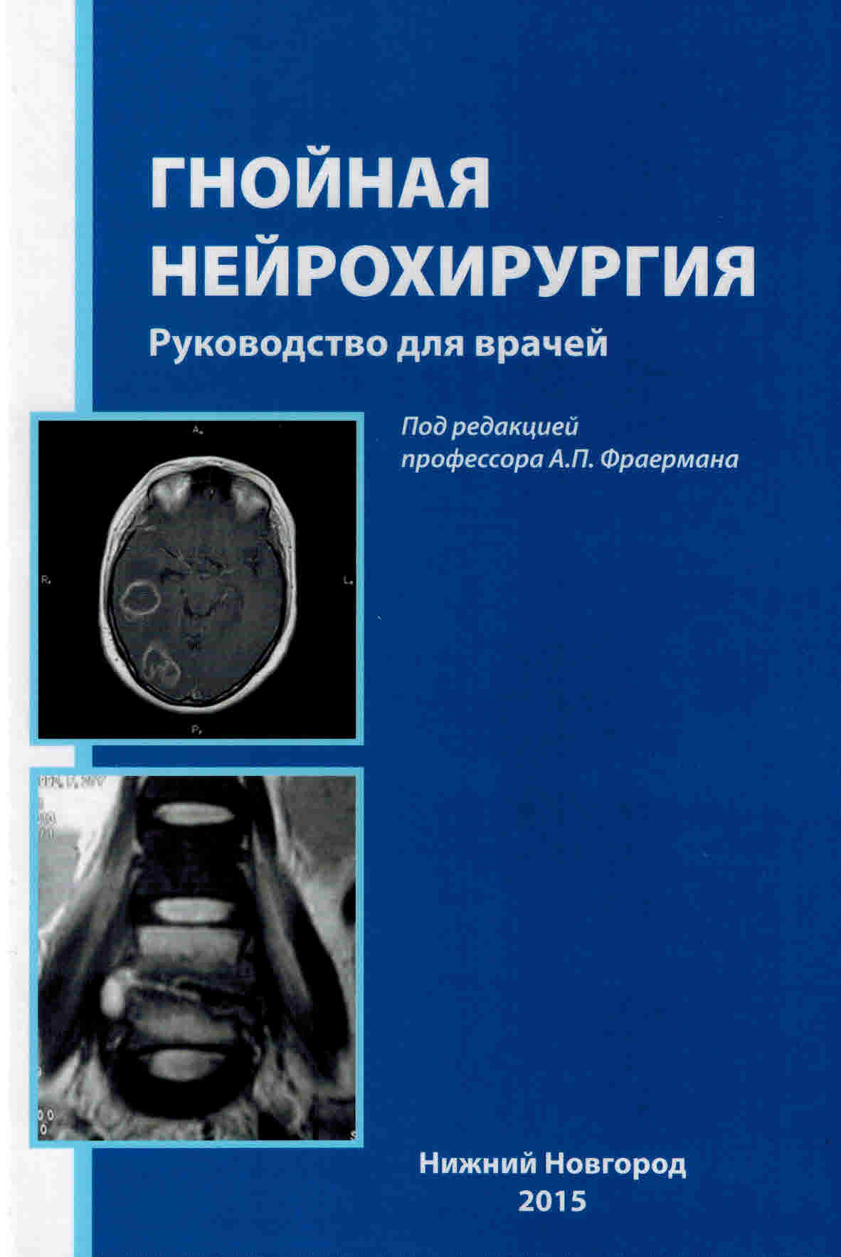 Учебники по гнойной хирургии Гнойная нейрохирургия gn_neirohir.jpg
