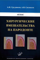 Хирургические вмешательства на пародонте. Атлас