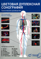 Цветовая дуплексная сонография