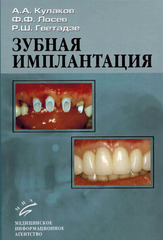 Зубная имплантация