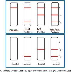 Тест-система SARS-CoV-2 Antibody Test (colloidal gold immunochromatography) для экспресс-анализа антител к коронавирусу иммунохроматографическим методом (20 тестов/уп) Бейджинг Лепу Медикал Технолоджи Ко., Лтд., Китай