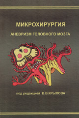 Микрохирургия аневризм головного мозга