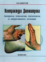 Контрактура Дюпюитрена (вопросы этиологии, патогенеза и оперативного лечения)