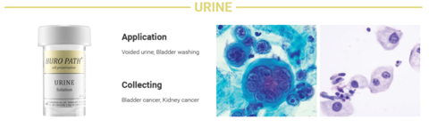 Слайд-процессор для проводки цитологического материала HURO PATH T