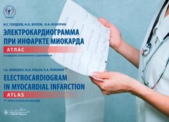 Электрокардиограмма при инфаркте миокарда : атлас на рус. и англ. яз. = Electrocardiogram in myocardial infarction : atlas in russian and english languages