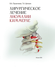 Хирургическое лечение аномалии Киммерле